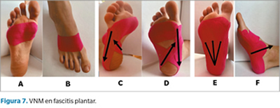 Cinta Kinesio Tape Neuromuscular Vendaje Deportivo Terapia Rosa PBOLD