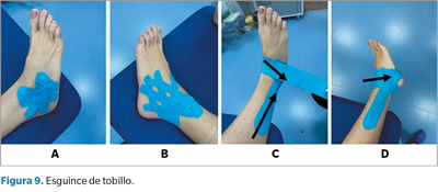 Colocar KINESIOTAPE en TOBILLO 🦶🏼 Vendaje Neuromuscular de Tobillo 